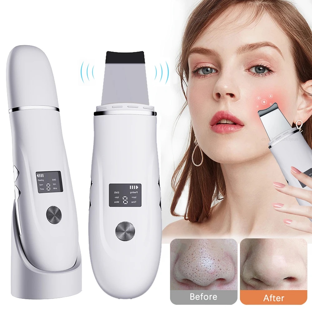 Xparata™ Ultrasonic Skin Face Scrubber