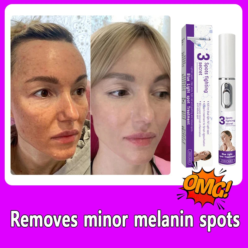 Facial Spots Disappear, Making You 18 Years Younger (Pack Of 1Pcs)